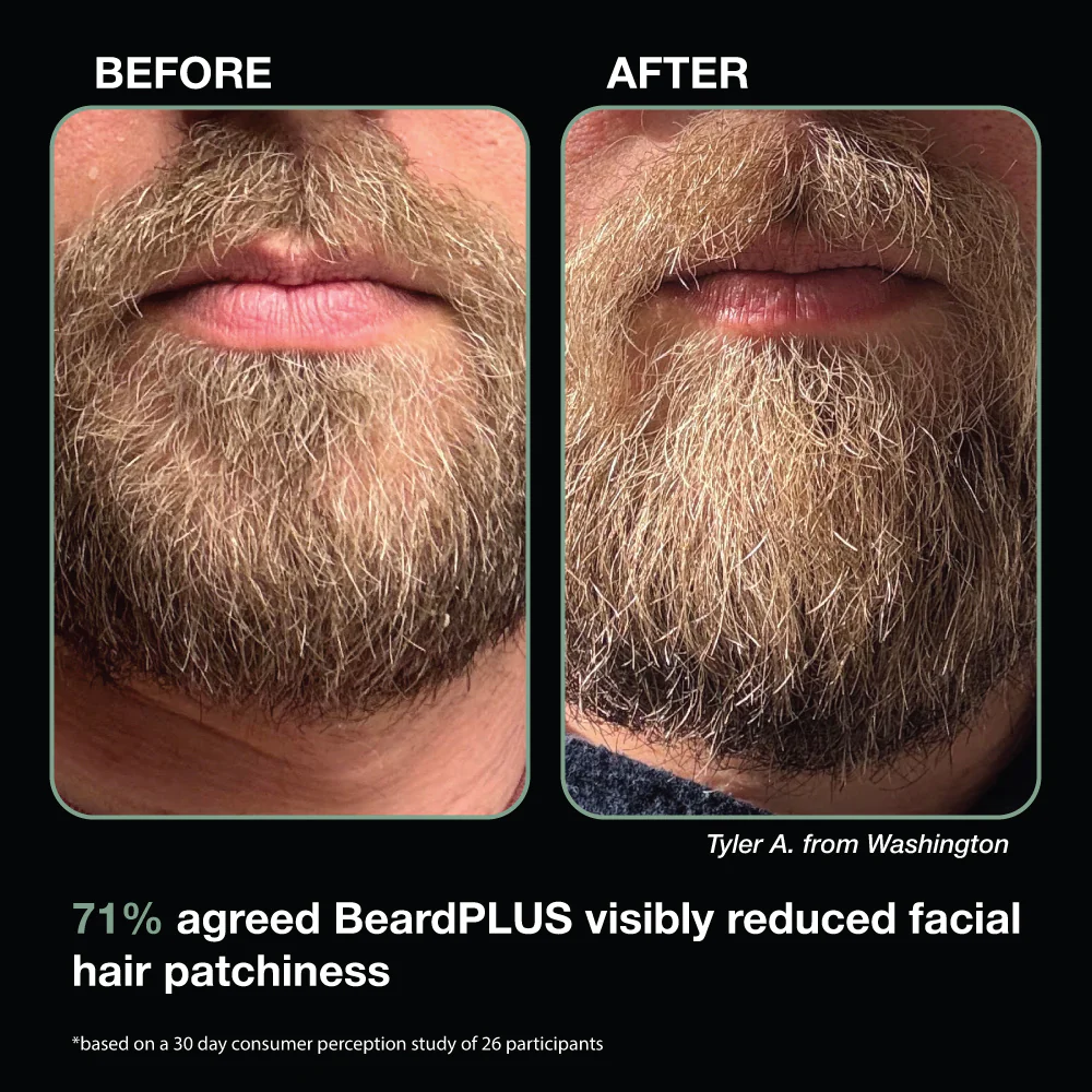 BeardPLUS Serum - Image 3