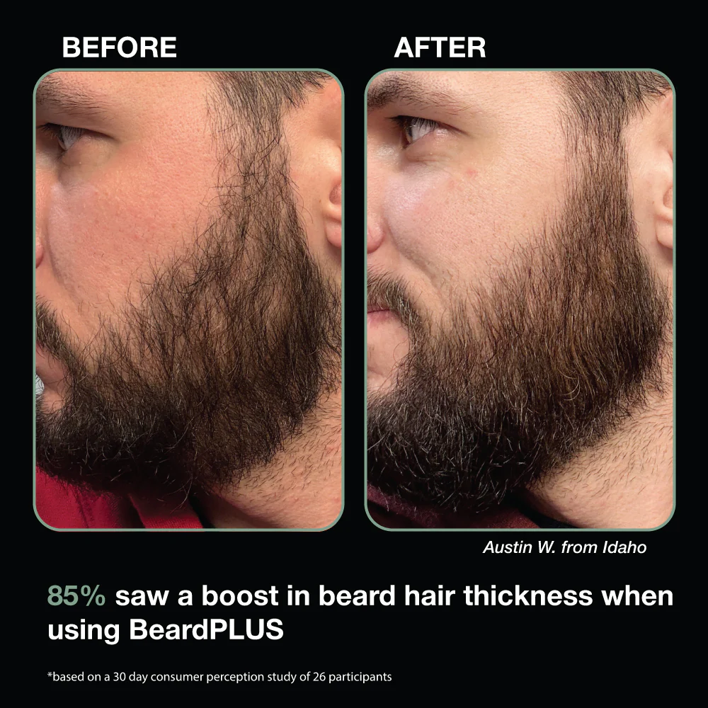BeardPLUS Serum - Image 4